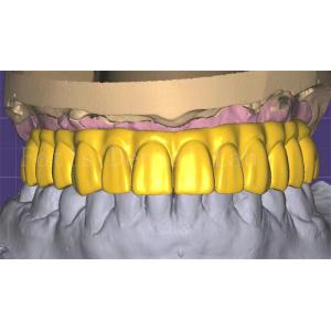 Cheap Professional 3shape Crown Design Excellent Performance And Durability for sale