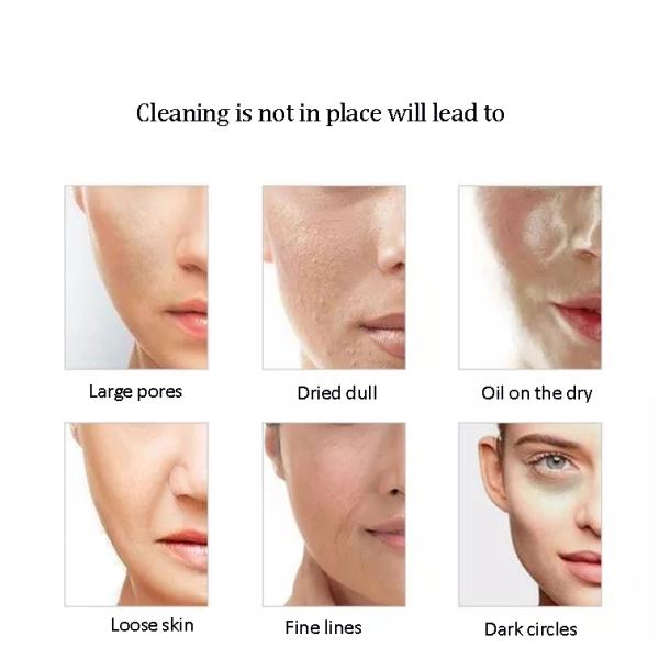 Face Lift Home Use Beauty Device