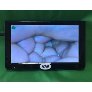 Portable Digital Electronic Colposcope