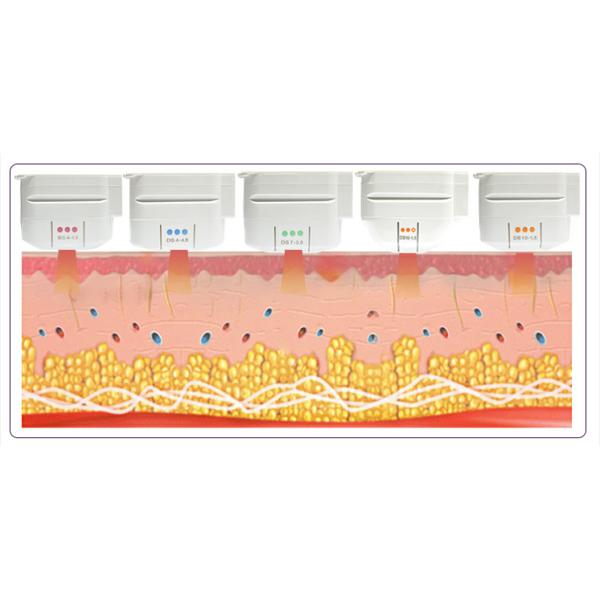 Germany Motor HIFU Machine For Shaping And Slimming With ABS Shell