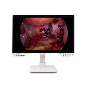 27 Medical-Grade All-in-One Camera System with Shoutcut Key Function and Fiber Optic Lens Type