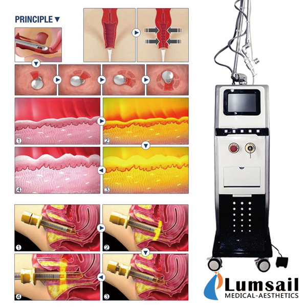 Stationary 30W Vaginal CO2 Fractional Laser Machine