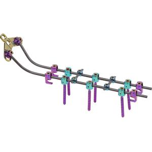 Spinal Rod System U Multi Axial Pedicle Screw Break Off