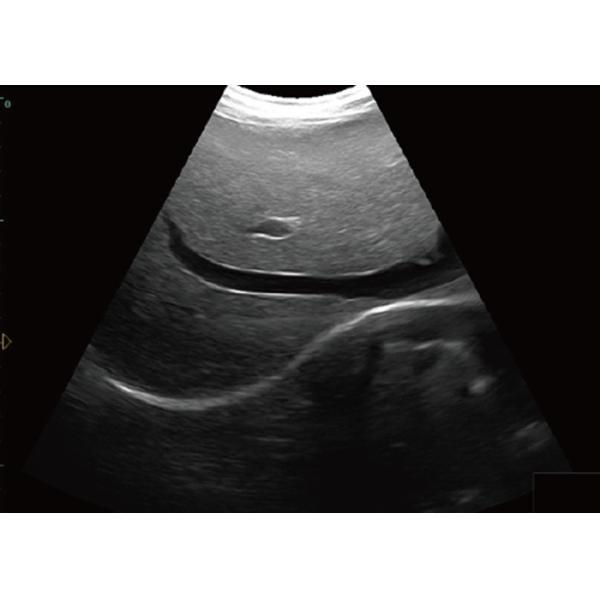 Quality Notebook Ultrasound Scanner Easy to Carry Laptop Ultrasound Scanner With Touch Screen Control Panel wholesale