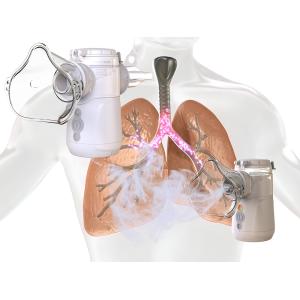 Cheap Advanced Medical Mesh Nebulizer Noise Level≤32dB Fine Particles Inhaler No Residual for sale