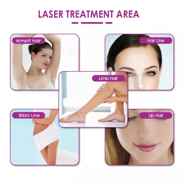 Professional Portable Diode Laser Hair Removal 755 nm 808 nm 1064 nm 808nm laser hair removal Machine