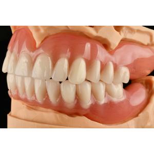 Cheap Invisible Partial / Full Dentures Odorless Hypoallergenic Acrylic Removable Dentures for sale