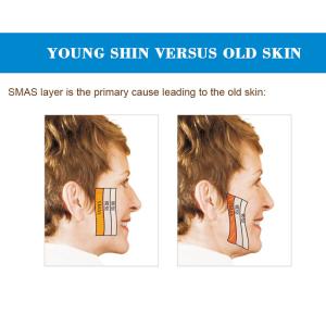 Face Lifting Rf 2 In 1 Radio Frequency Machines Body Slimming With 3 Handle