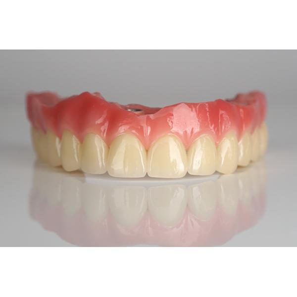 Full Arch Zirconia Implant Bridge All-On-Four / All On Six Dental Implants Fast