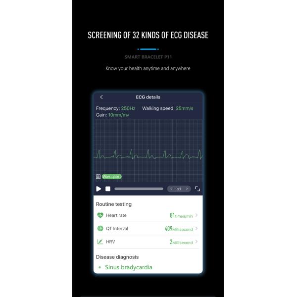 ECG PPG Pedometer HR Monitor Smart Band Fitness Tracker Watch With Blood Pressure