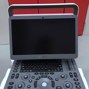 MSK Ultrasound TDI CW Color Sonoscape E2 E3 & Sonoscape E1 Usg