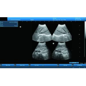 3D Digital Laptop Portable Ultrasound Scanner With All Kinds of Probe