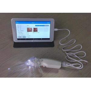 Portable Self-Colposcope For Gynecology Connected To Monitor Computer Television