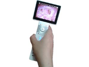 Cheap Digital Skin Camera Hair Magnifier Machine With Mini USB Port Transmit Images to PC Displaying Pictures at Same Time for sale