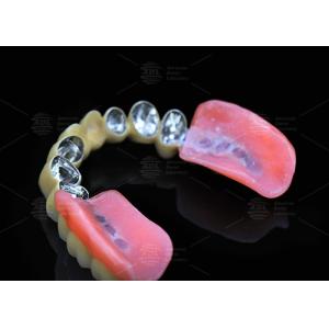 Telescope Inner Co-Cr And Outer Co-Cr Metal Partial With Composite