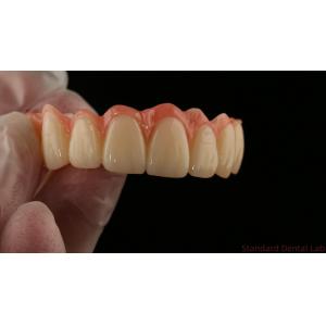 Porcelain All On Four Zirconia Bridge High Esthetics Dental Implant Bridge