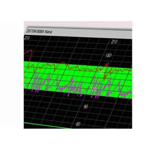 10.2" TFT Display Fetal / Maternal Monitor Patient Heart Monitor With Built-in