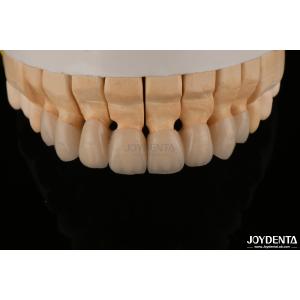 High Translucency Layered Zirconia Crowns Bridges Dental Restorations lifelike
