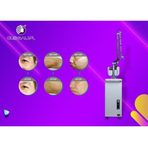 1064 Nm / 532nm Nd Yag Laser Tattoo Removal Machine 800mj Single Pulse Energy