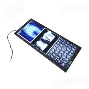 X Ray Film Viewer / Quadruble Panel Medical LED Film Viewer