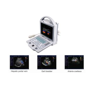 China B Ultrasound Scanner Portable Doppler Ultrasound Machine with Only 4.5Kgs Weight on sale