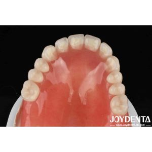 Good Elasticity Dental Acrylic Denture Finish With Tooth Arrangement Technology