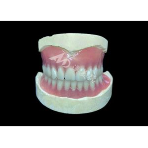Easy-to-Clean Custom Cast Partial Dentures Ideal for Restoring Chewing Ability
