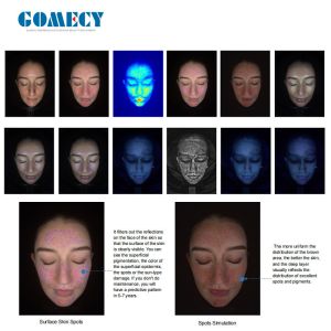 GOMECY Magic Mirror Face Skin Test Machine Analyzer Skin Scanner Skin Analysis