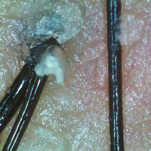 Handheld Wireless Wifi Skin Analyzer Scalp And Hair Tester With 3.5 Inch Screen