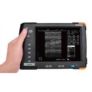 Palm Ultrasound ScannerSU-V5(ultrasonic,black white,Imaging System)