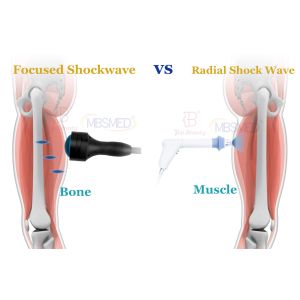 Electromagnetic Focused Shockwave Therapy Fswt Machine Erectile Dysfunction