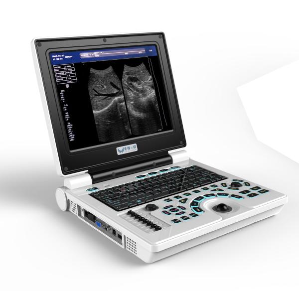 Advanced Technology Ultrasound Scanning Machine with 4 Focus and Long-Lasting Li