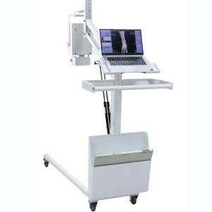 Cheap High Frequency Mobile Digital Radiography Machine Digital X Ray Equipment for sale