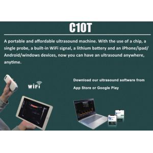 5G Wifi Handheld Ultrasound Scanner Pocket Ultrasound Built - in 4200mAh Lithium