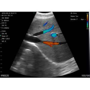 Wifi Ultrasound Probe Convex Linear Phasedarray 80/128/192 Color Doppler