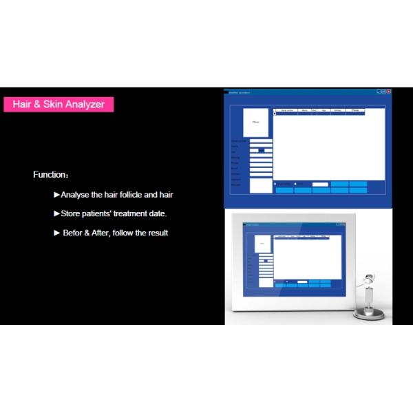 2016 NEW Sanhe SH650-1 808nm 650nm low level laser hair regrowth machine with CE