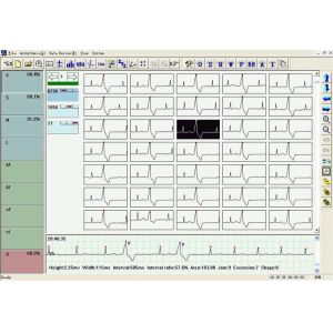 OLED display 48 Hours Recorder TLC6000 Dynamic 12 Lead ECG Holter Systems