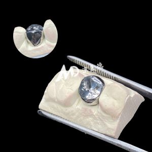 Metal Titanium Crown Precision Strength and Biocompatibility for Lasting