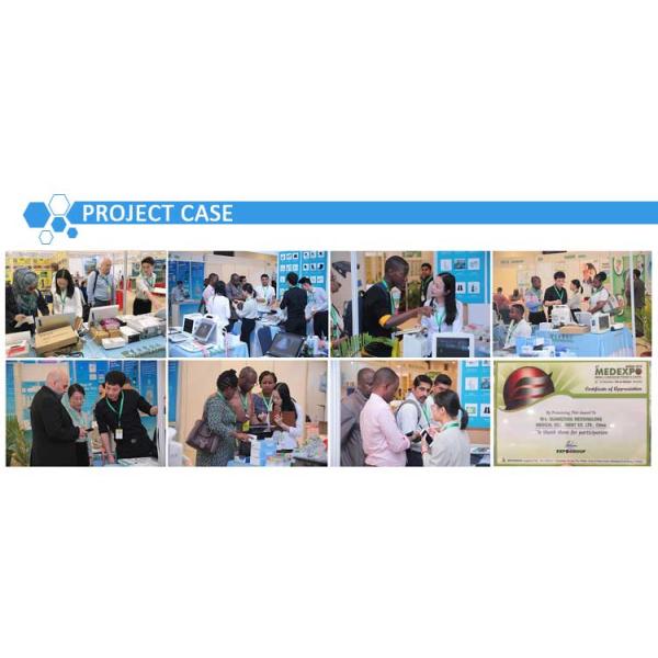 E2V Veterinary Ultrasound Doppler Color Sonoscape E2