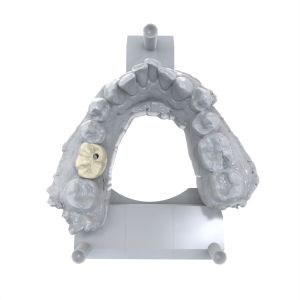 Flexible Permanent Crown Resin Strong Adhesion and Compatibility with Ceramic