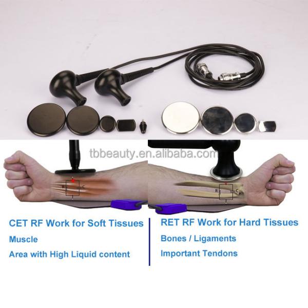 Penetrates 12CM Under 448khz Tecar Device Skin Deep Health Weight Loss Tecartherapy