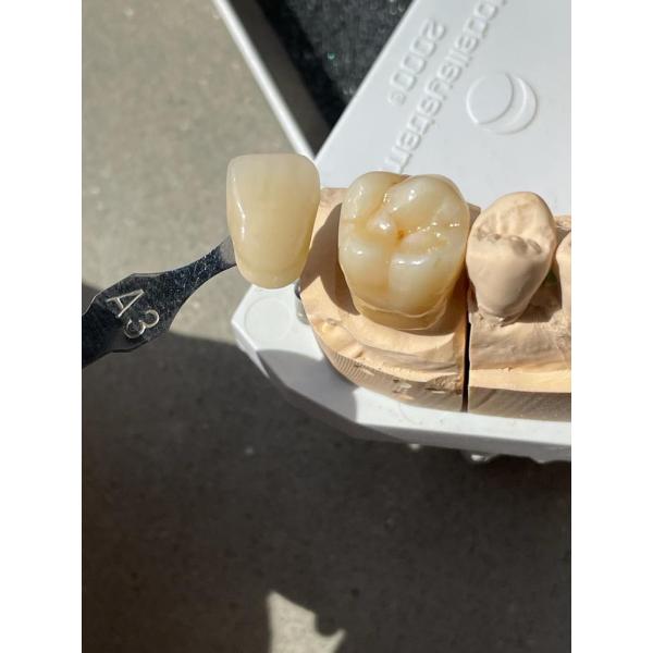 1000 Mpa Multilayer Zirconia Dental Material 98*18mm Super High Translucency