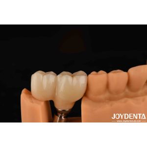 Cheap V Shaped Thread Type Finished Abutments Compatibility With All Major Implant Systems for sale