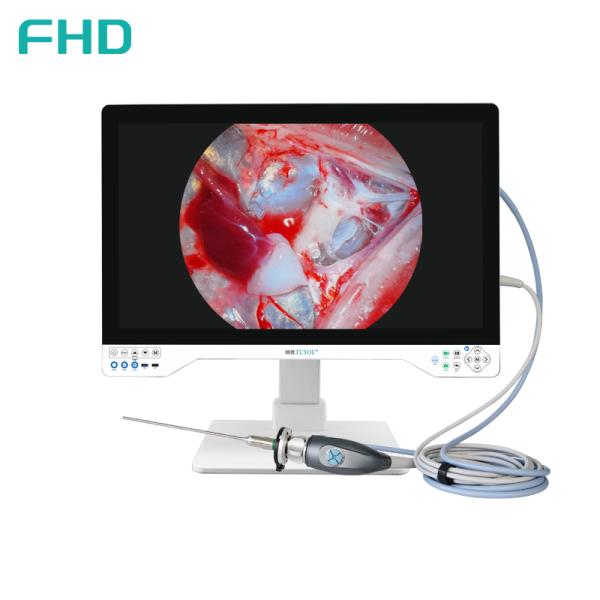 Quality TUYOU All-in-One FHD Endoscopy Camera System with 32 Inches Surgical Monitor for ENT and Urology Procedures wholesale