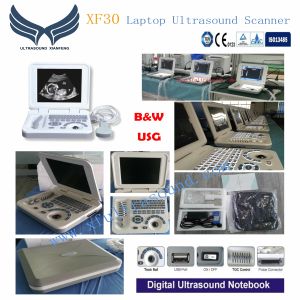 Notebook Veterinary Ultrasound Machines Digital Ultrasound Scanner Rectal Probe