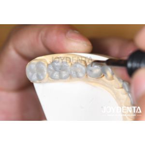 Temporary Use Diagnostic Wax Ups Smooth Texture Teeth Wax Up Custom