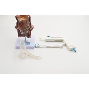 Cheap Short Recovery Time Piles Treatment Stapler Surgery , Staple Operation Of Piles At Home for sale