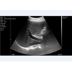 Wifi Handheld Ultrasound Scanner Portable Convex Linear Cardiac Multifrequency