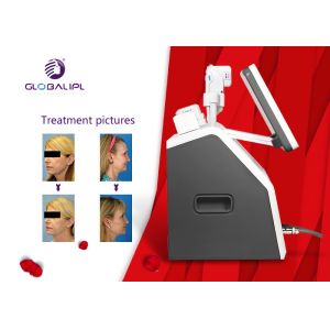 2 In 1 Hifu Facelift Machine 5 Cartriges For Wrinkle Removal / Body Slimming