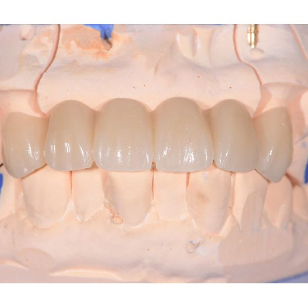 3D Gradients Multilayer Dental Zirconia Blanks 16 Shades For False Teeth